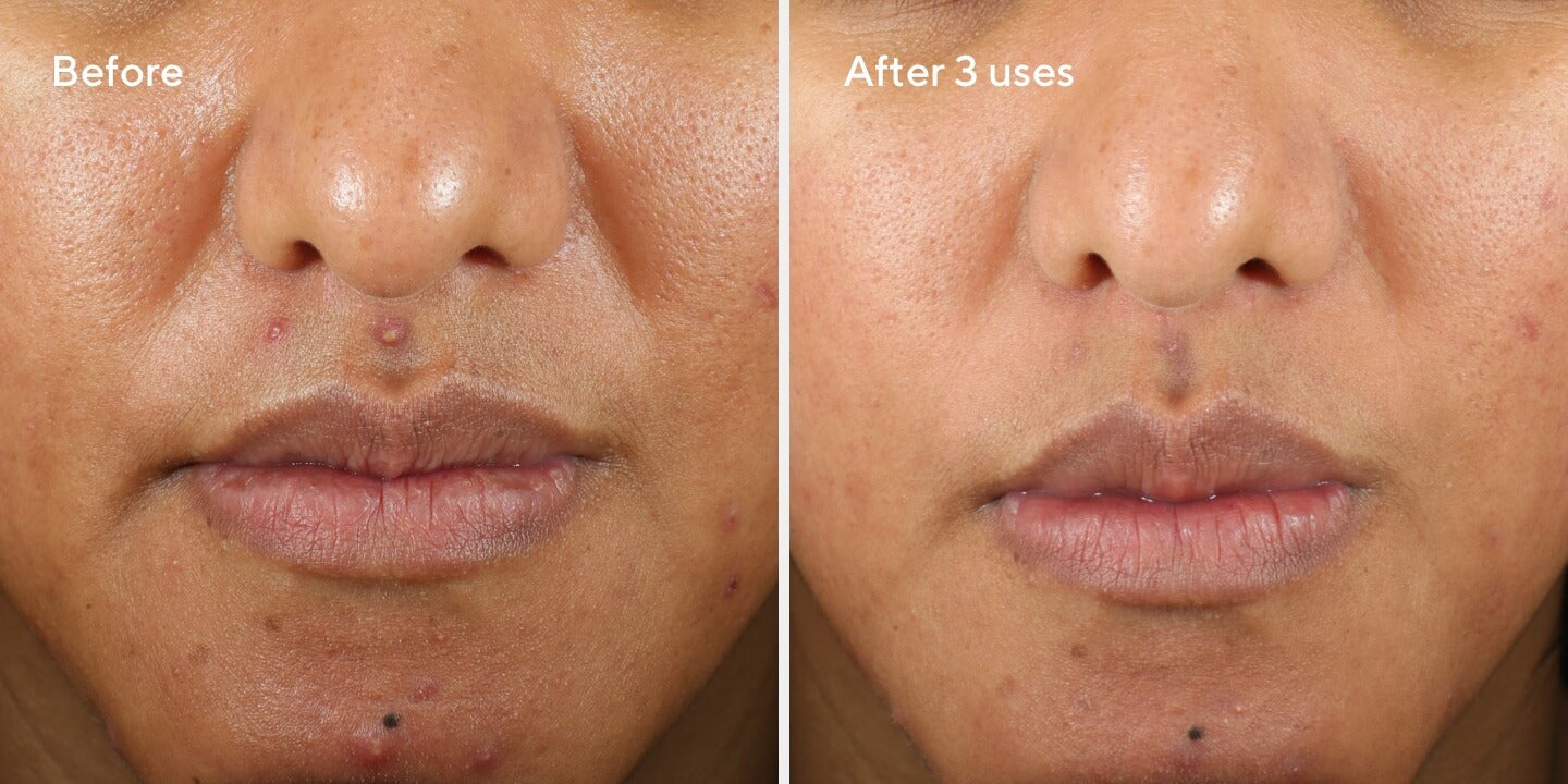 2023 June Rapid Relief Sulfur Mask B&A 1