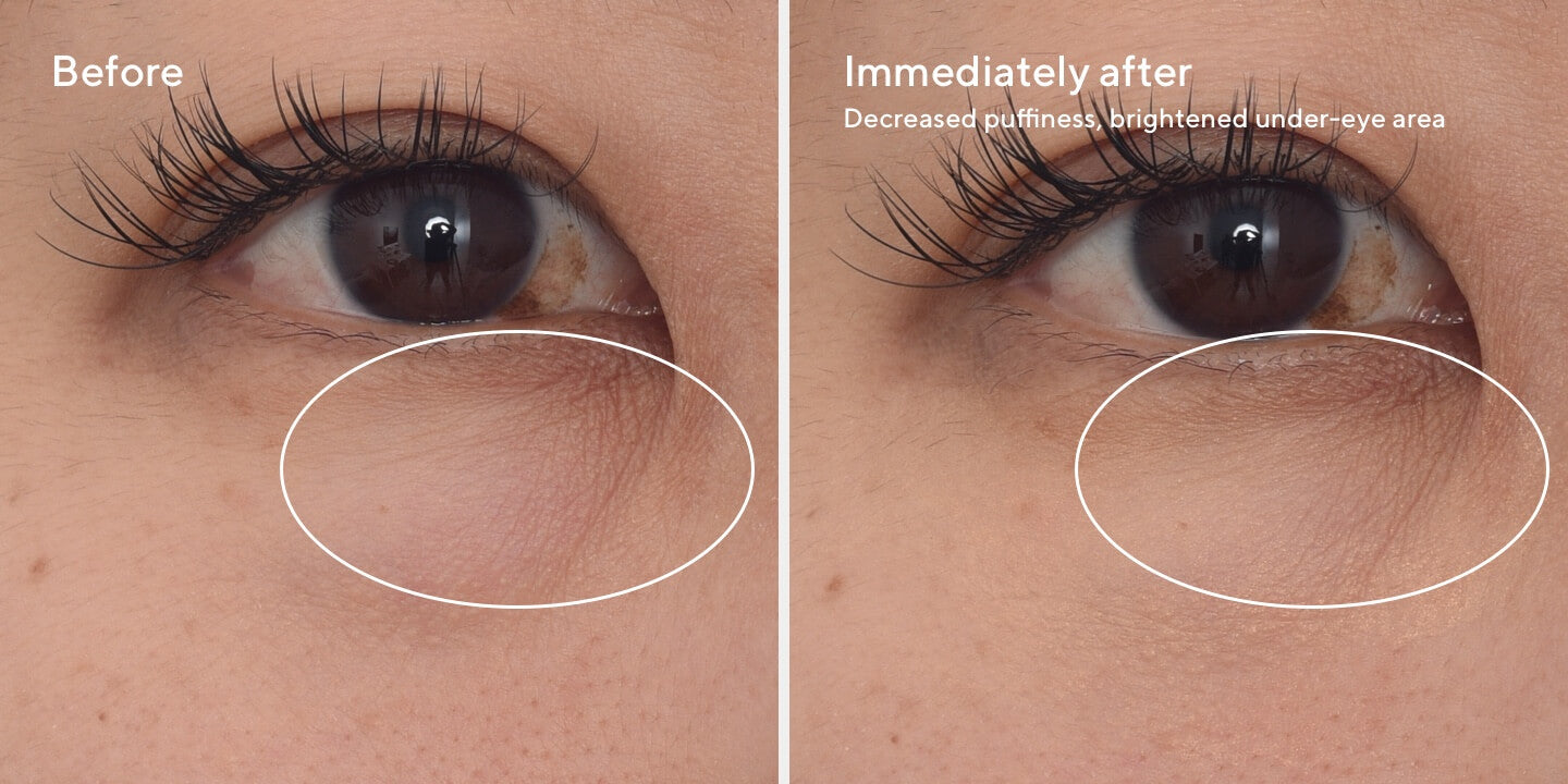 2023 Sept Targeted Eye Depuffer B&A 1