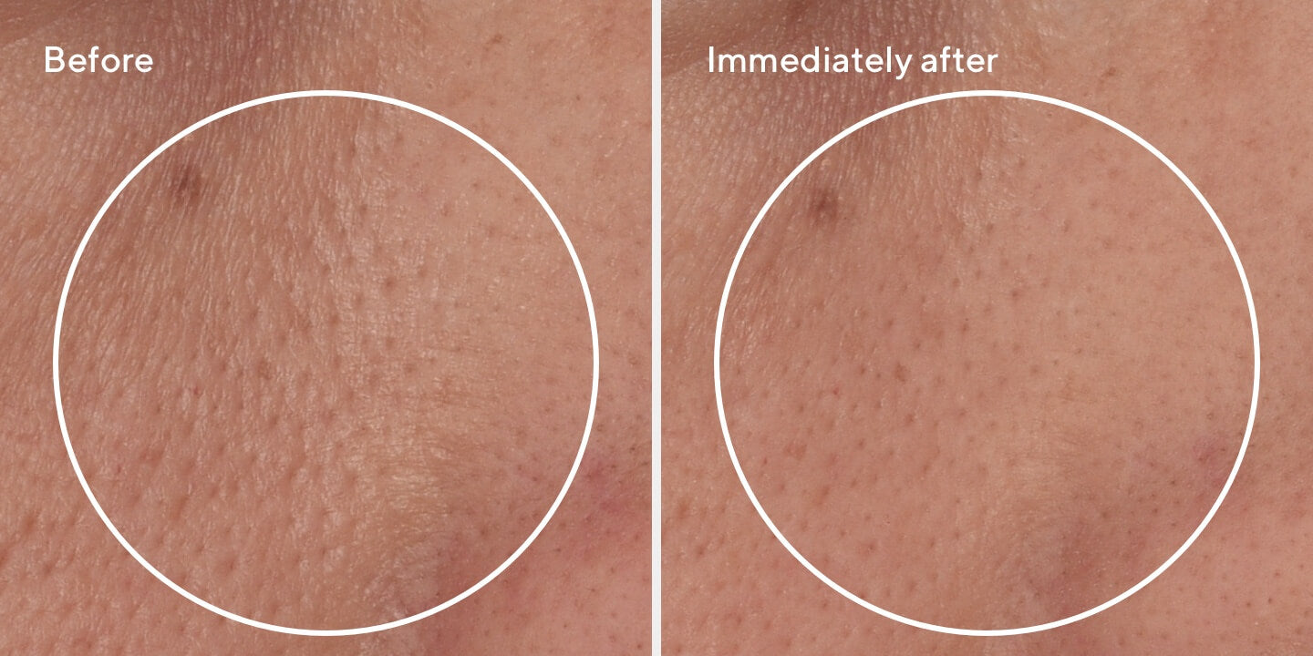 Targeted Pore Corrector B&A 1