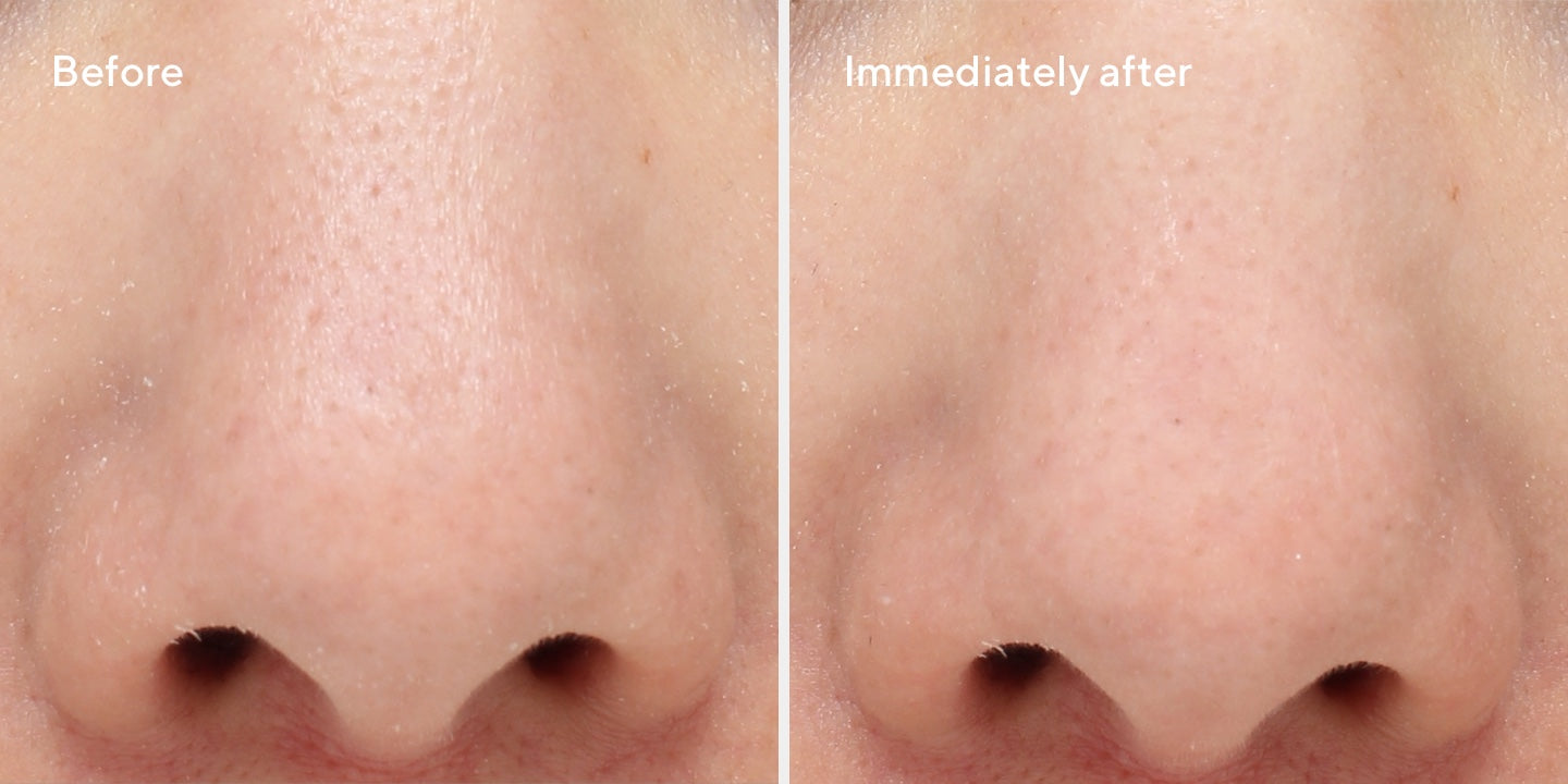 Targeted Pore Corrector B&A 2