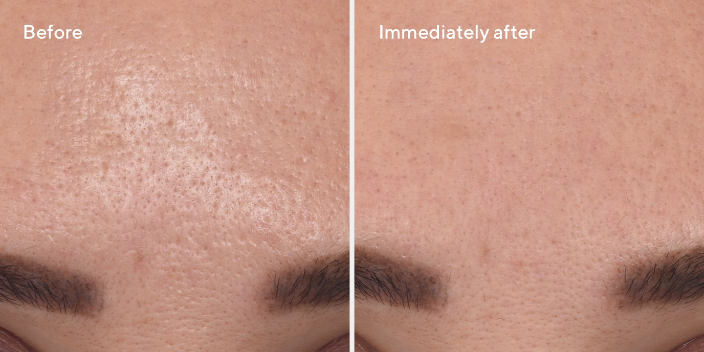 Targeted Pore Corrector B&A 3