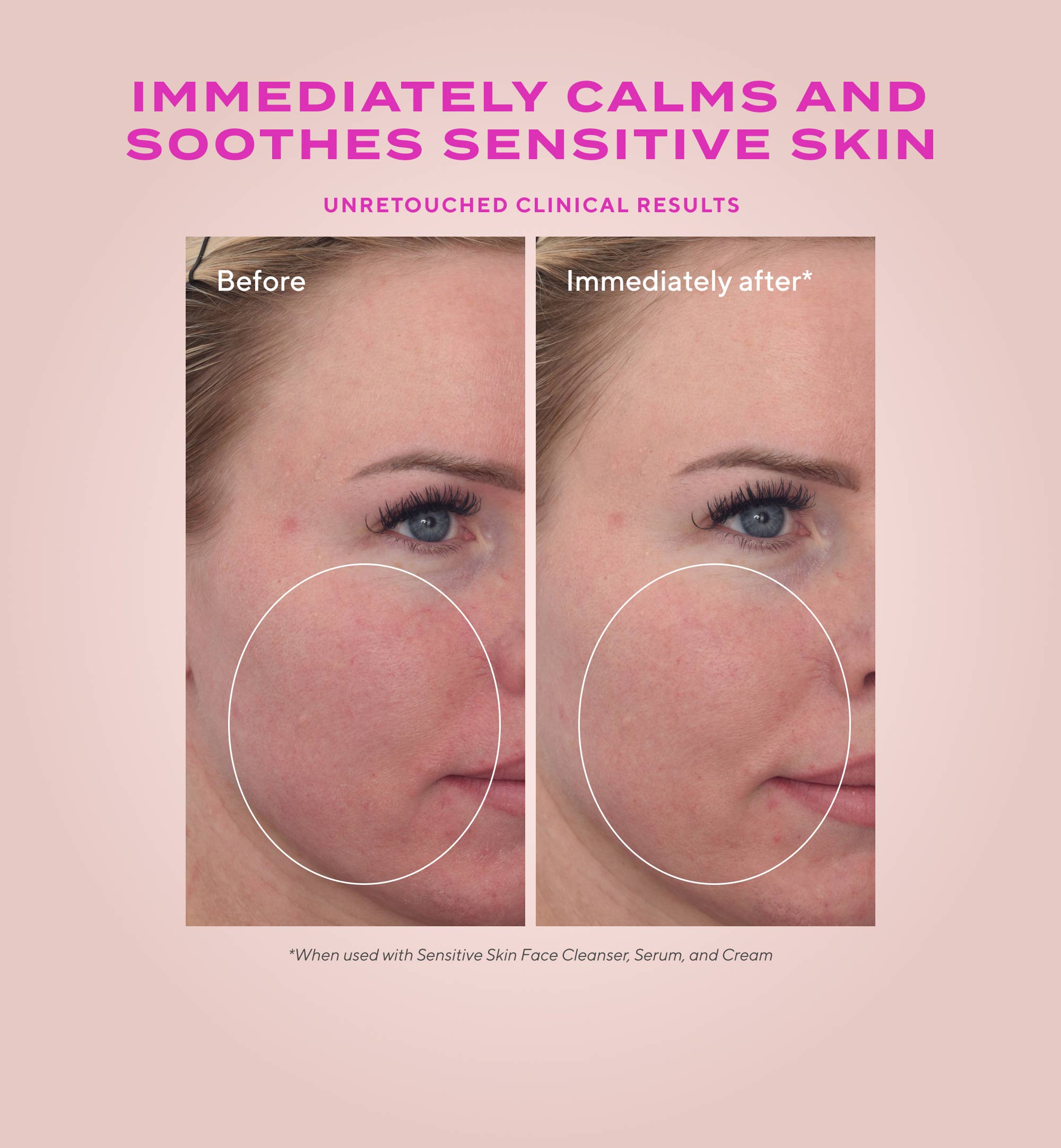 Heartleaf Calming Cream Moisturizer for Sensitive Skin and Eczema-Prone Skin