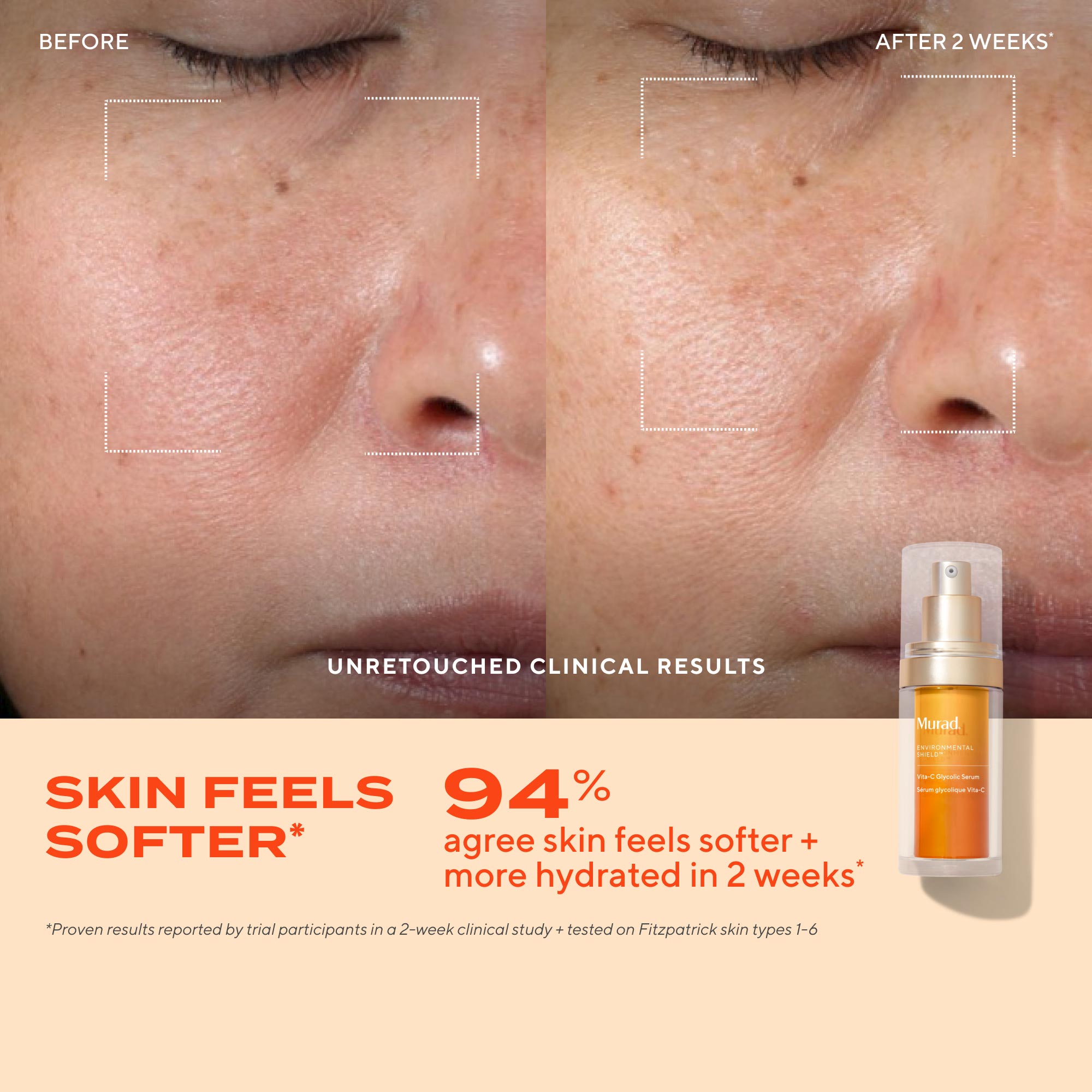 Vita-C Glycolic Serum Refill