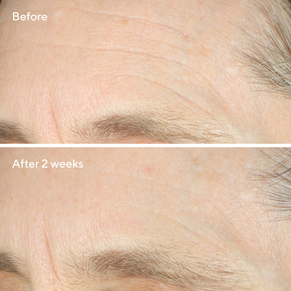 Intense Recovery Cream
