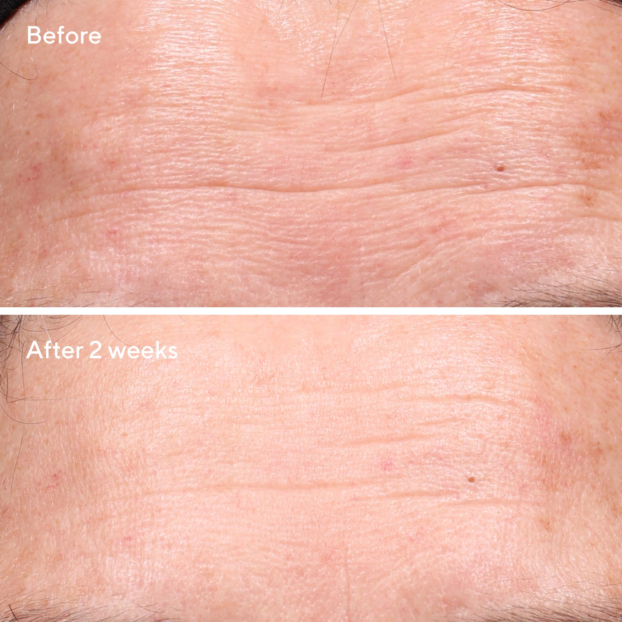 Retinol Youth Renewal Serum Larger Size