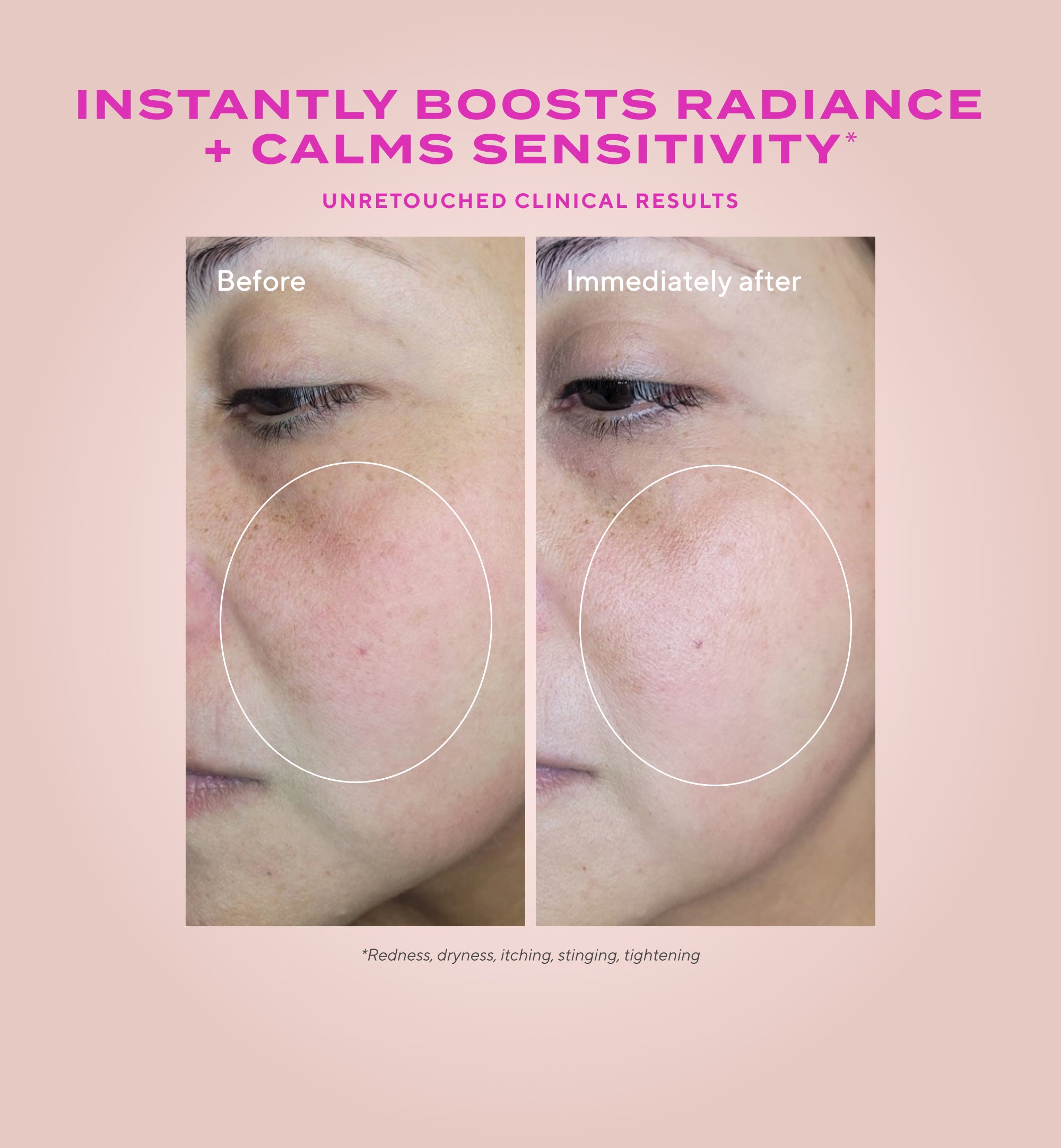 Gentle Glycolic Acid Resurfacing Serum for Sensitive Skin Refill
