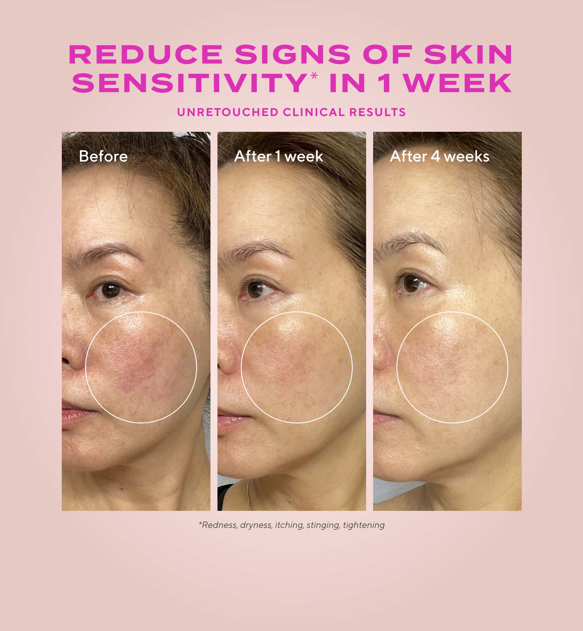 Gentle Glycolic Acid Resurfacing Serum for Sensitive Skin Refill