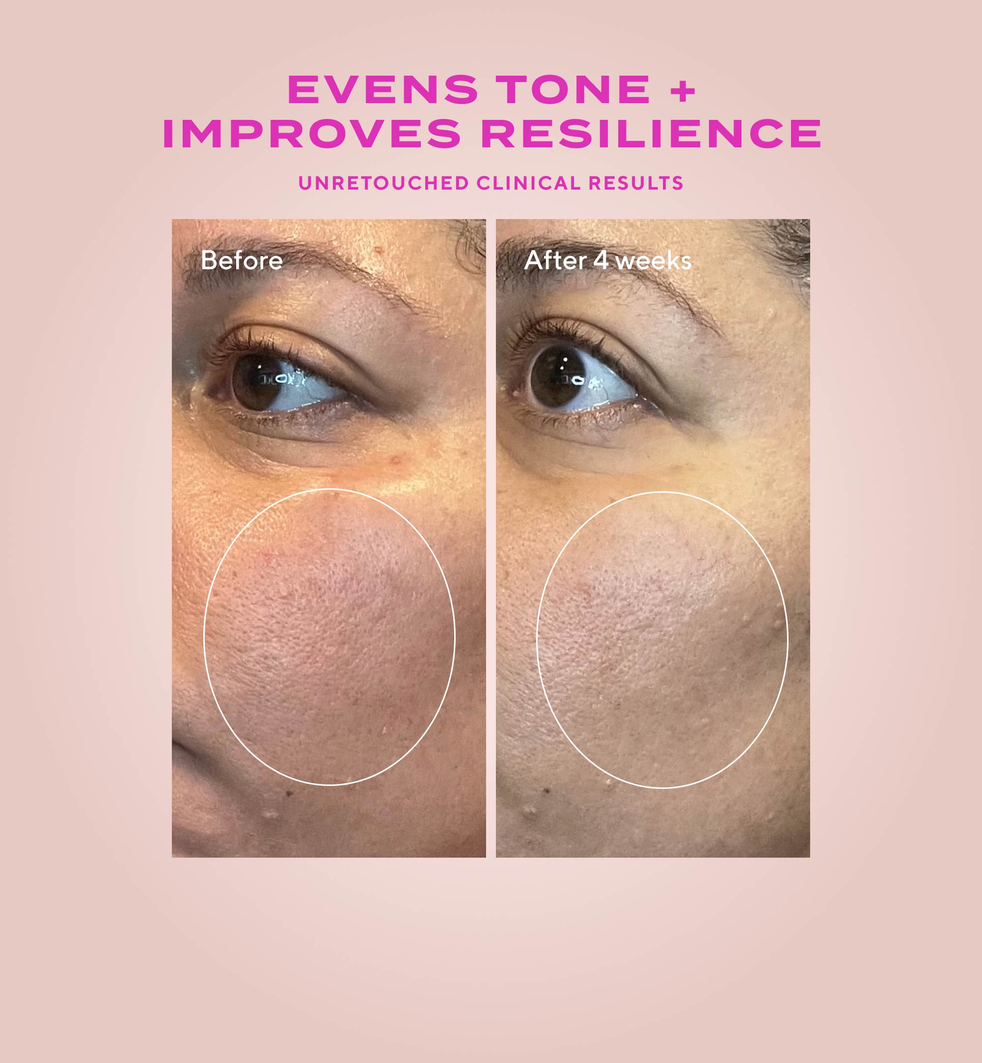 Gentle Glycolic Acid Resurfacing Serum for Sensitive Skin Refill