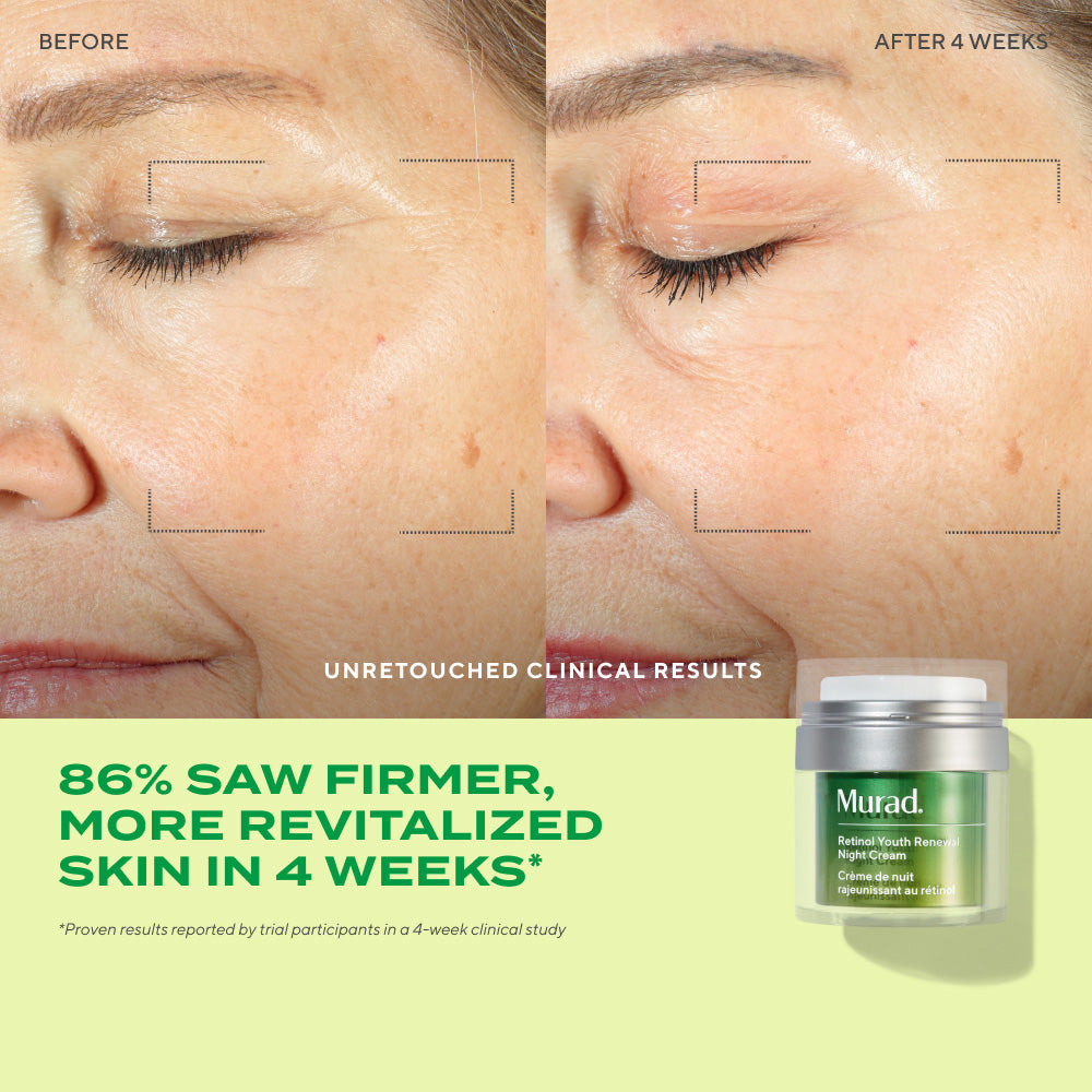 KEM DƯỠNG RETINOL MURAD LÀM MỀM DA VÀ CẢI THIỆN NẾP NHĂN VỚI CÔNG NGHỆ 3 TÁC ĐỘNG