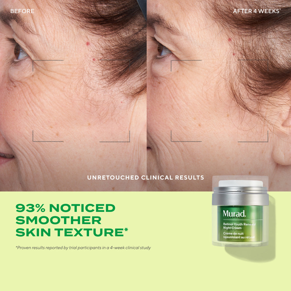 SERUM RETINOL MURAD DUNG TÍCH 15ML HỖ TRỢ LÀM MỜ NẾP NHĂN HIỆU QUẢ