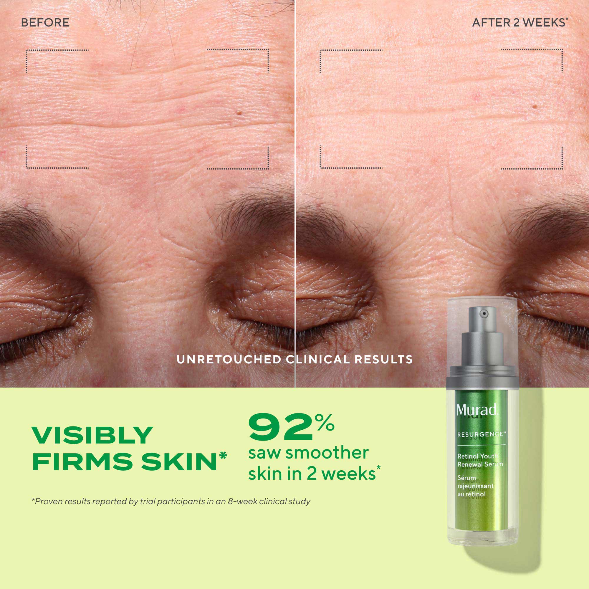 HƯỚNG DẪN SỬ DỤNG SERUM RETINOL MURAD VÀO BUỔI TỐI ĐỂ ĐẠT HIỆU QUẢ TỐT NHẤT
