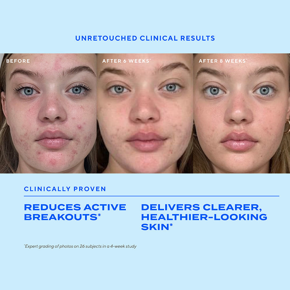 Biome-Balancing Clear & Prevent Acne Treatment Serum