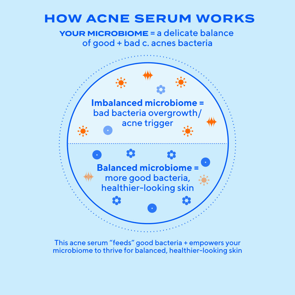 Clear Skin Acne Discovery Kit