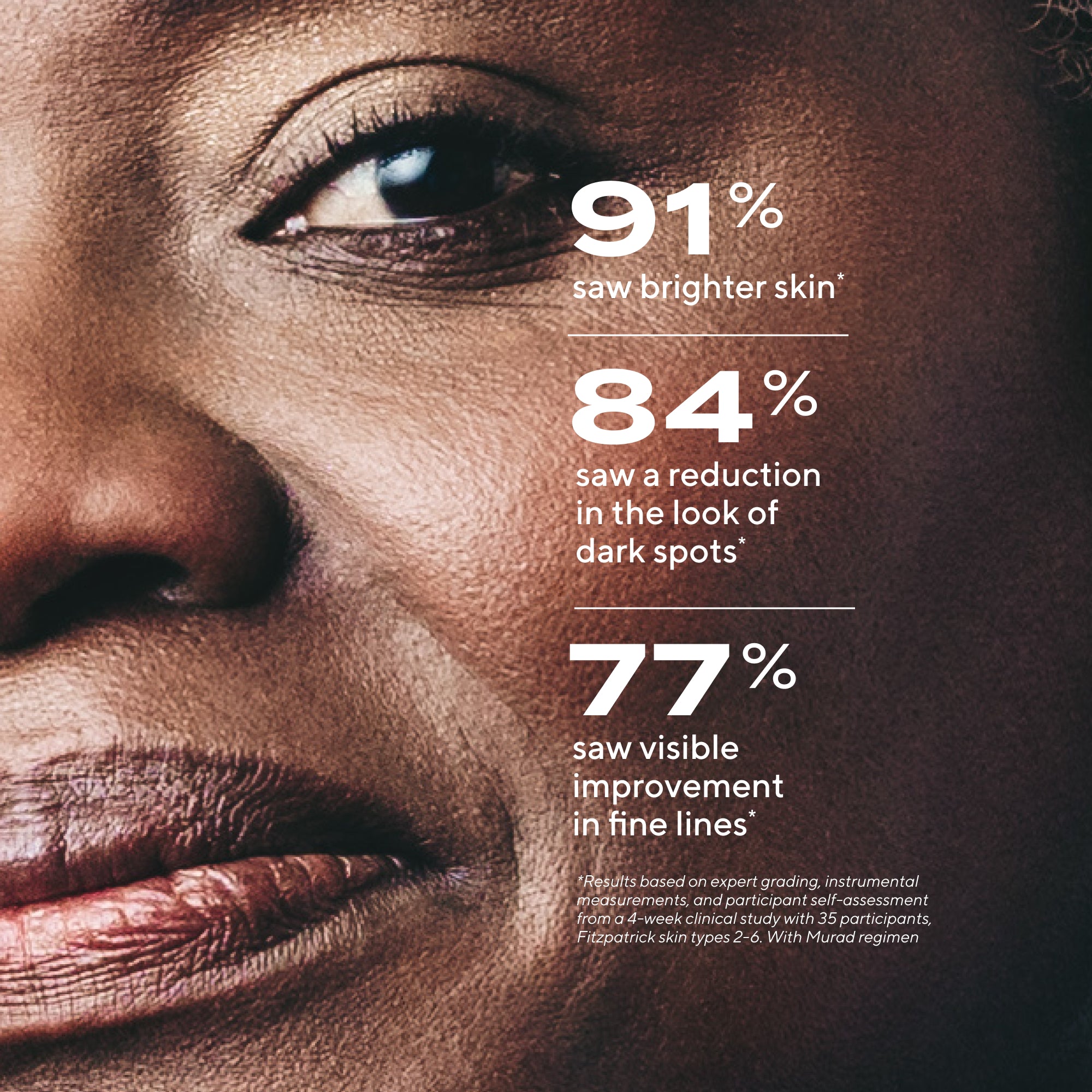 Rapid Dark Spot Correcting Serum