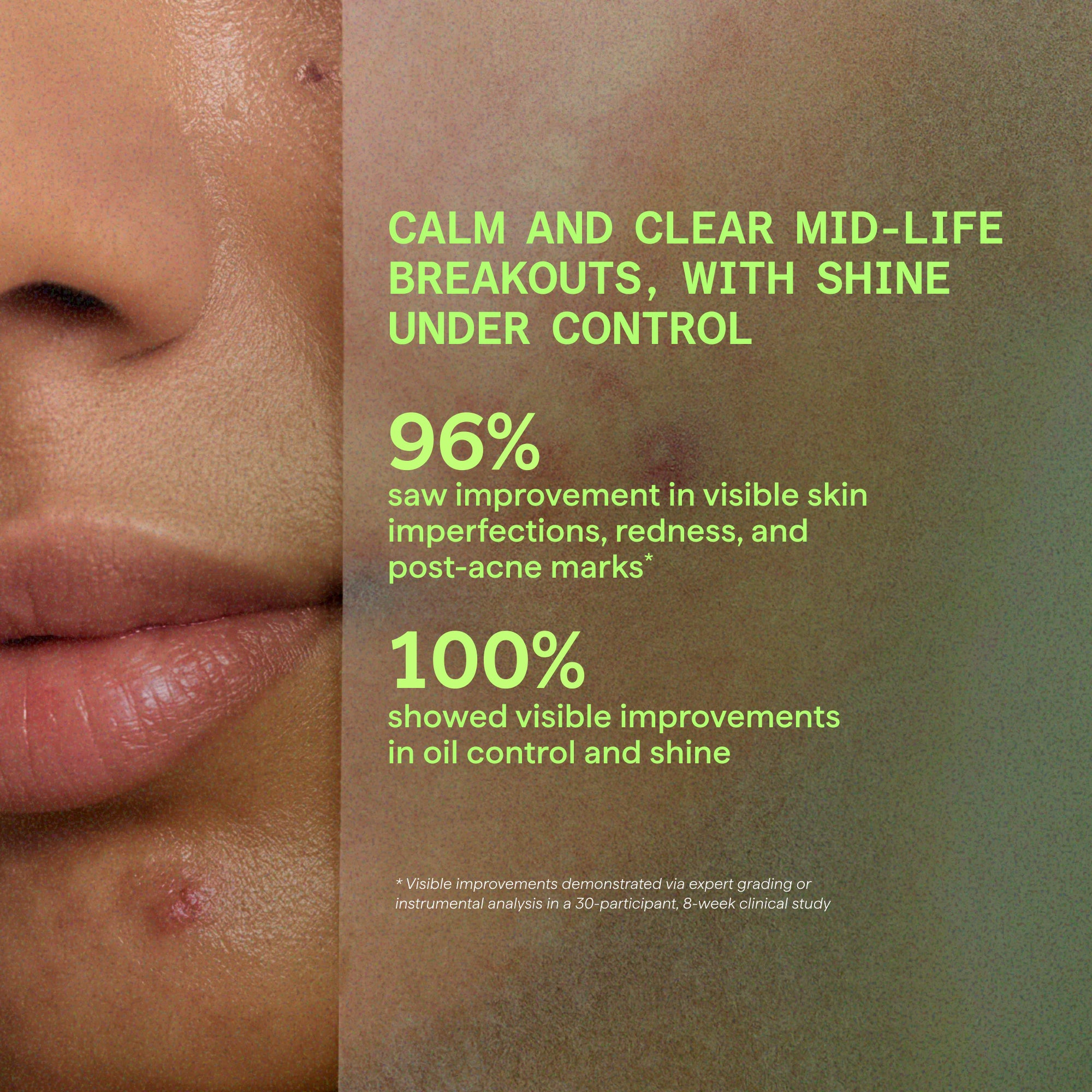 Biome-Balancing Calm & Recover Cream