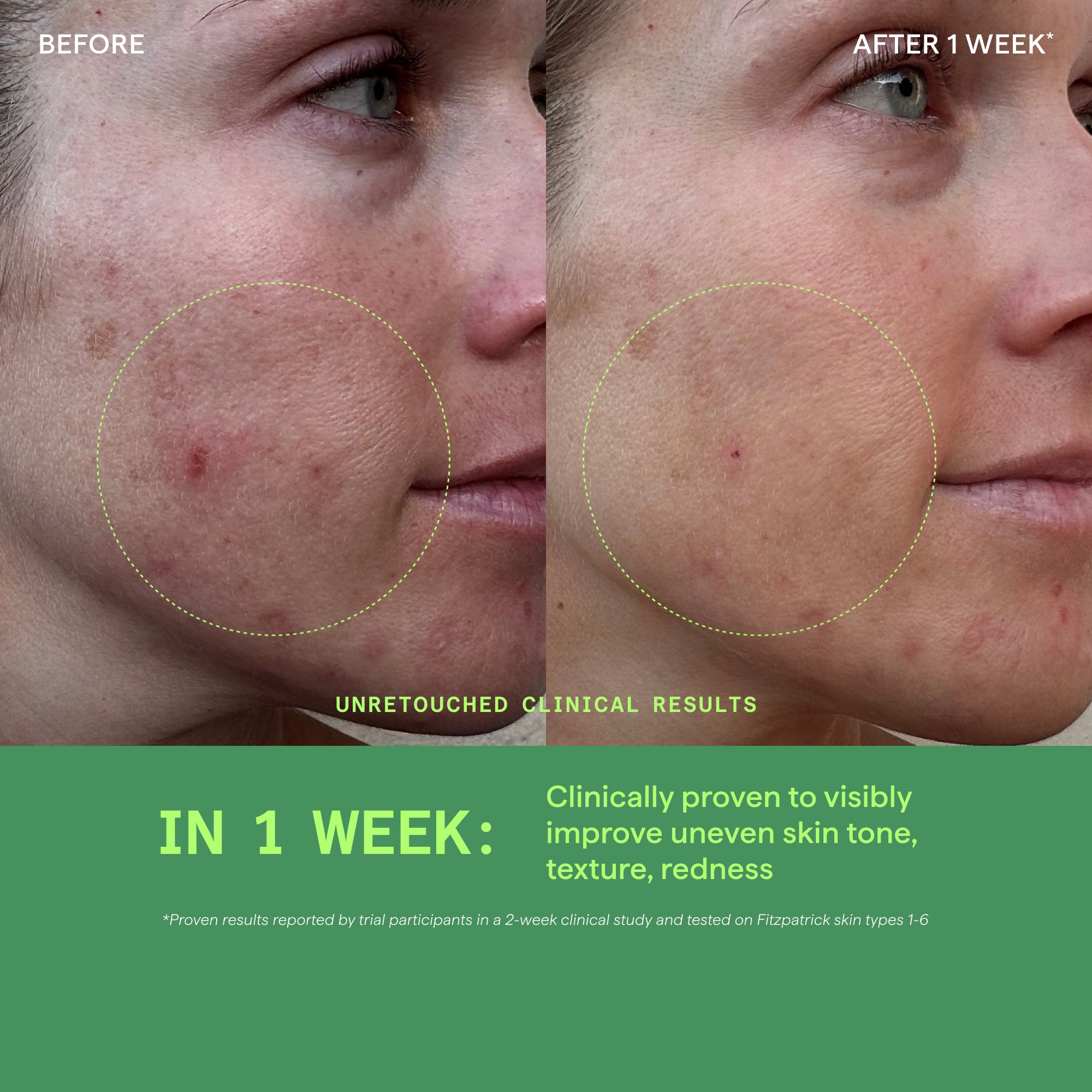 Biome-Balancing Calm & Recover Cream