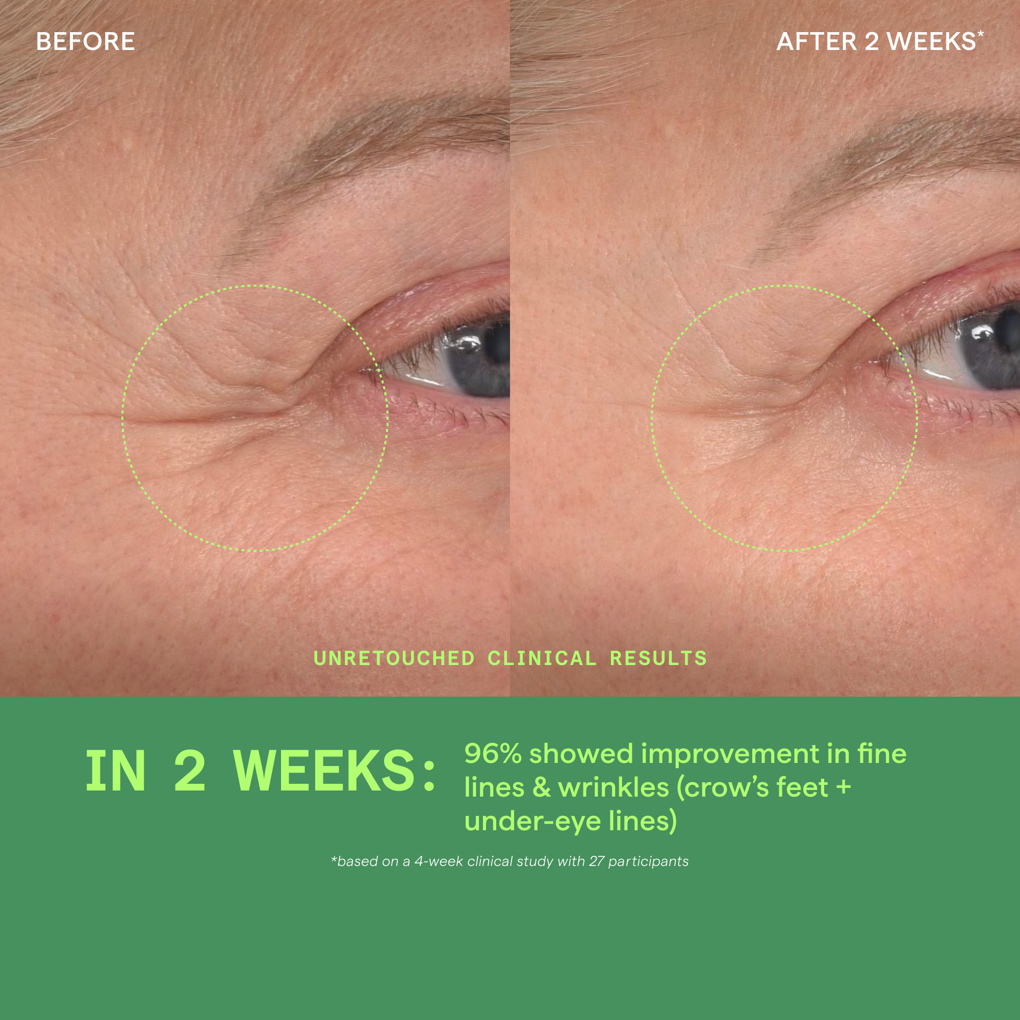 Retinol Youth Renewal Eye Serum