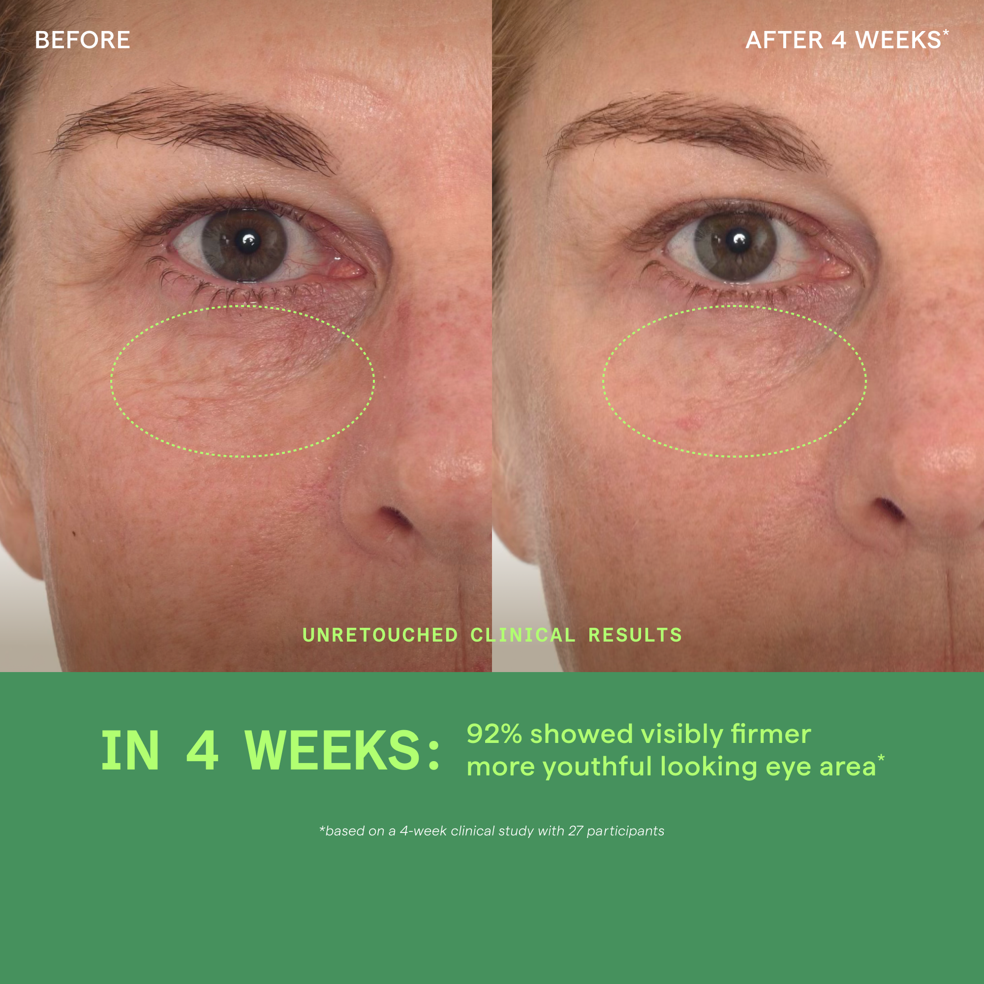 Retinol Youth Renewal Eye Serum