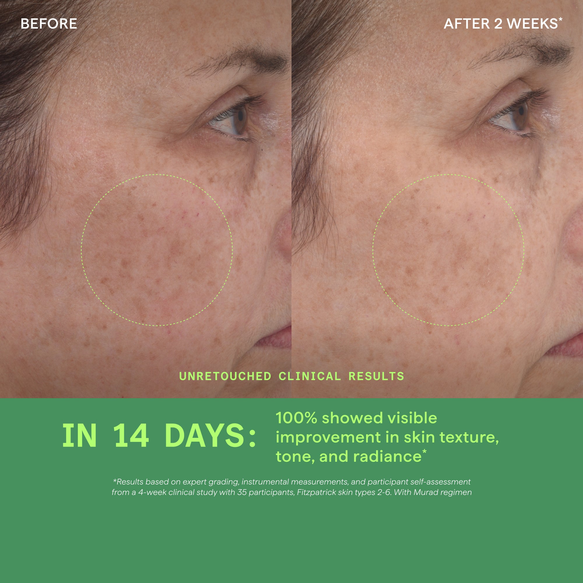 Retinol Youth Renewal Serum