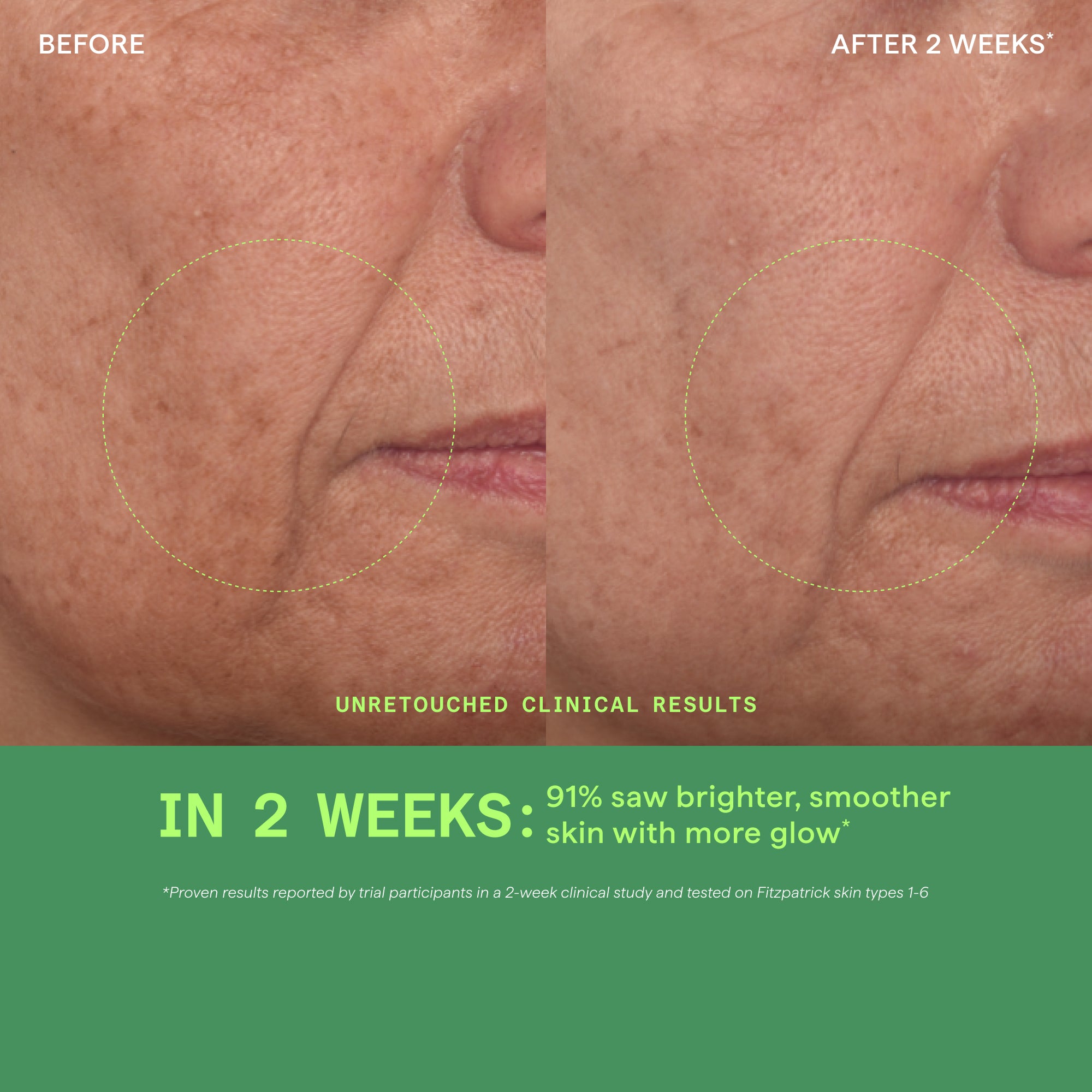 Vita-C Glycolic Acid Serum | Murad Skincare Vita-C Glycolic Acid Serum | Murad Skincare