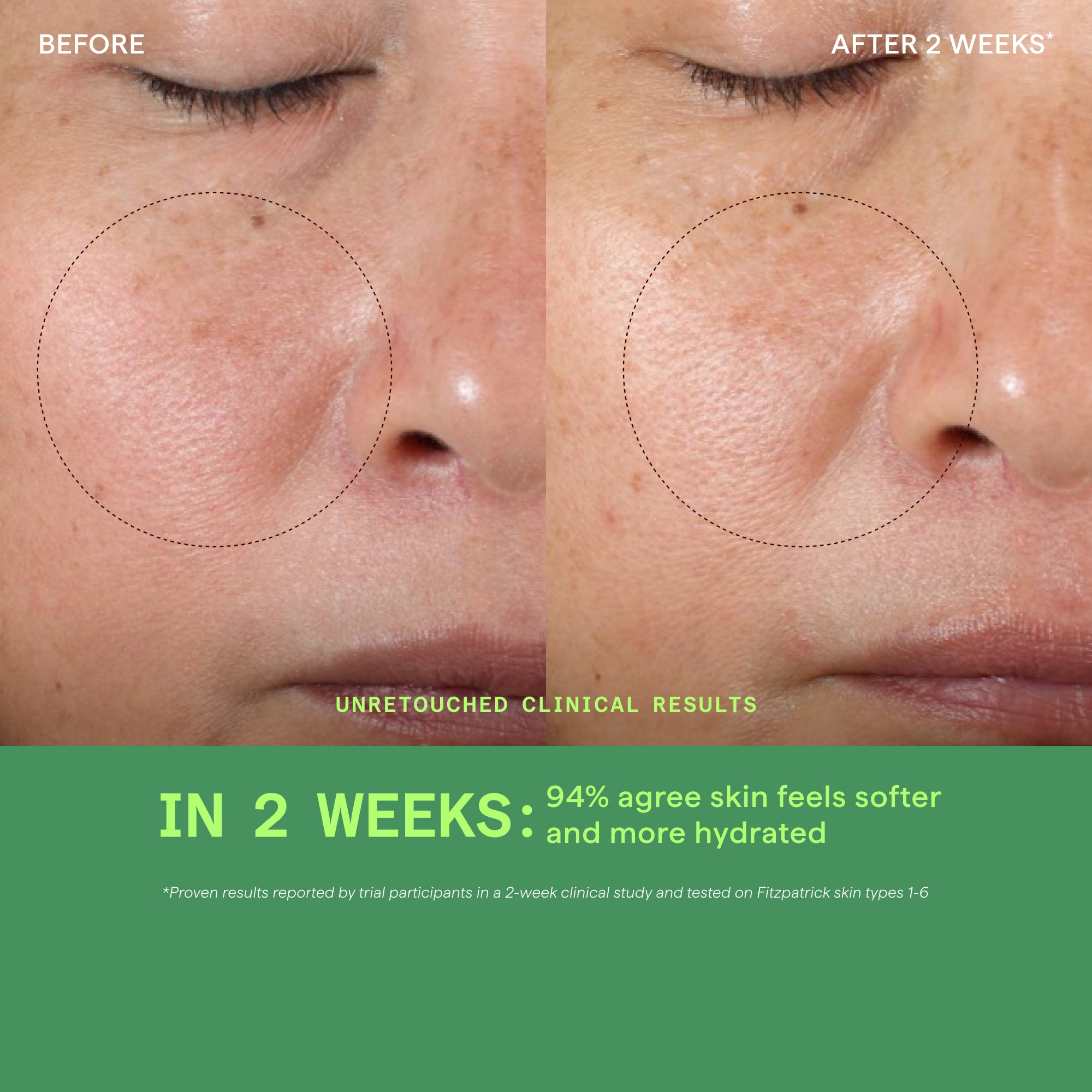 Vita-C Glycolic Serum Vita-C Glycolic Serum