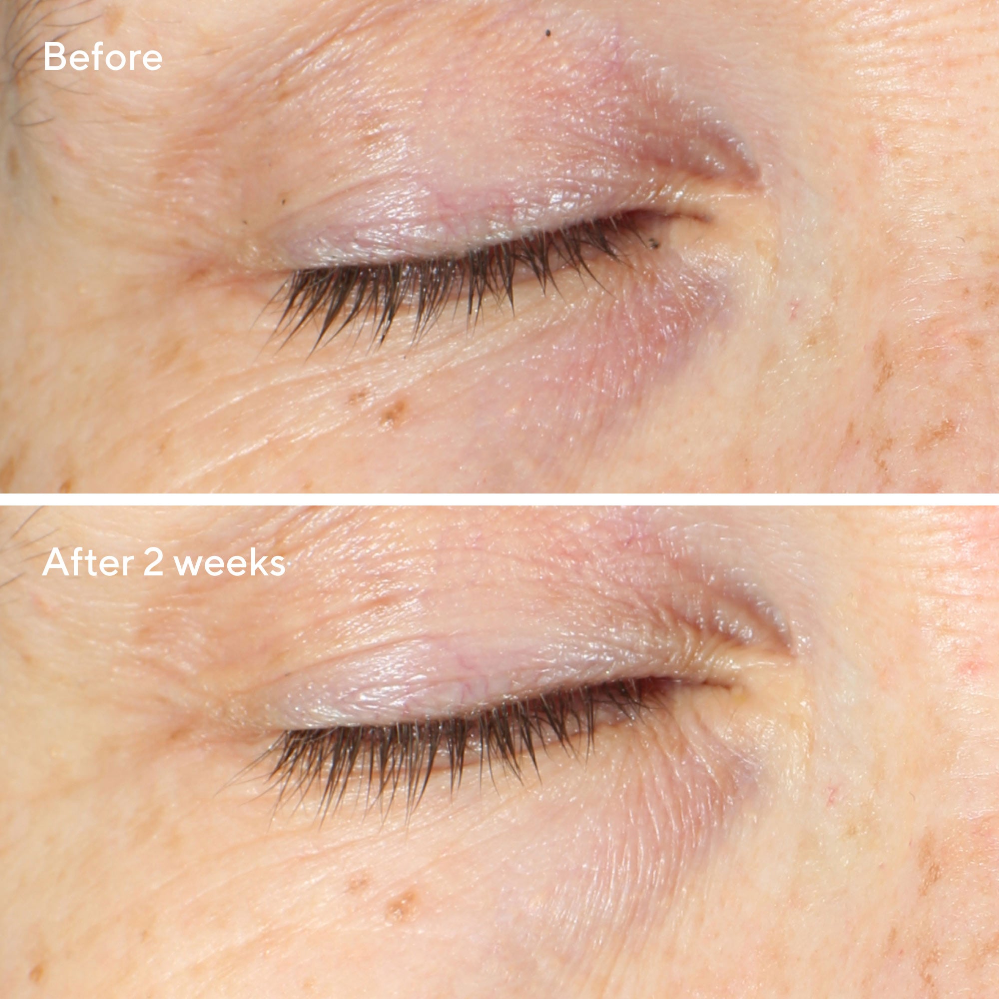 Vita-C Eyes Dark Circle Corrector