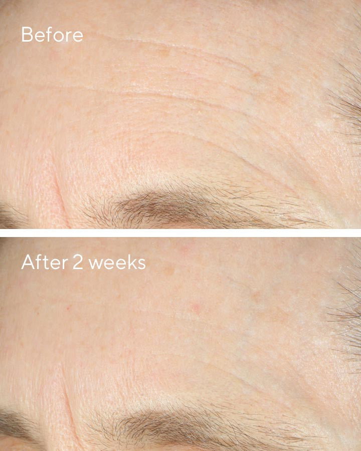 Murad Intense Recovery Cream Before and After