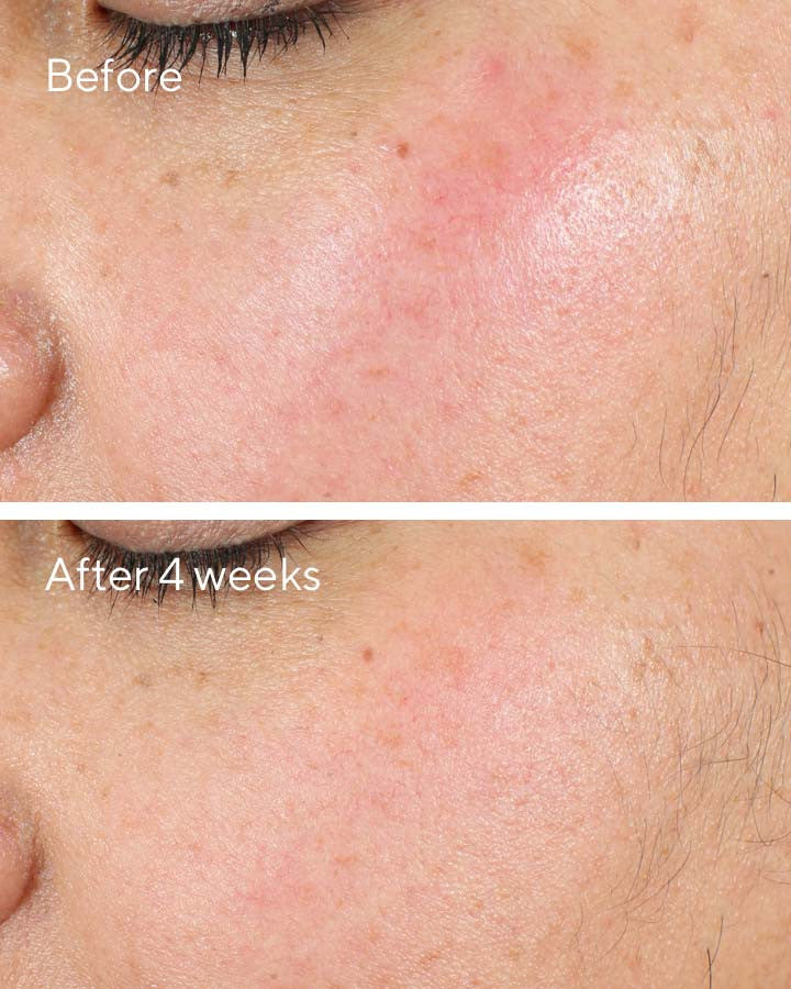 Murad Intense Recovery Cream Before and After 2