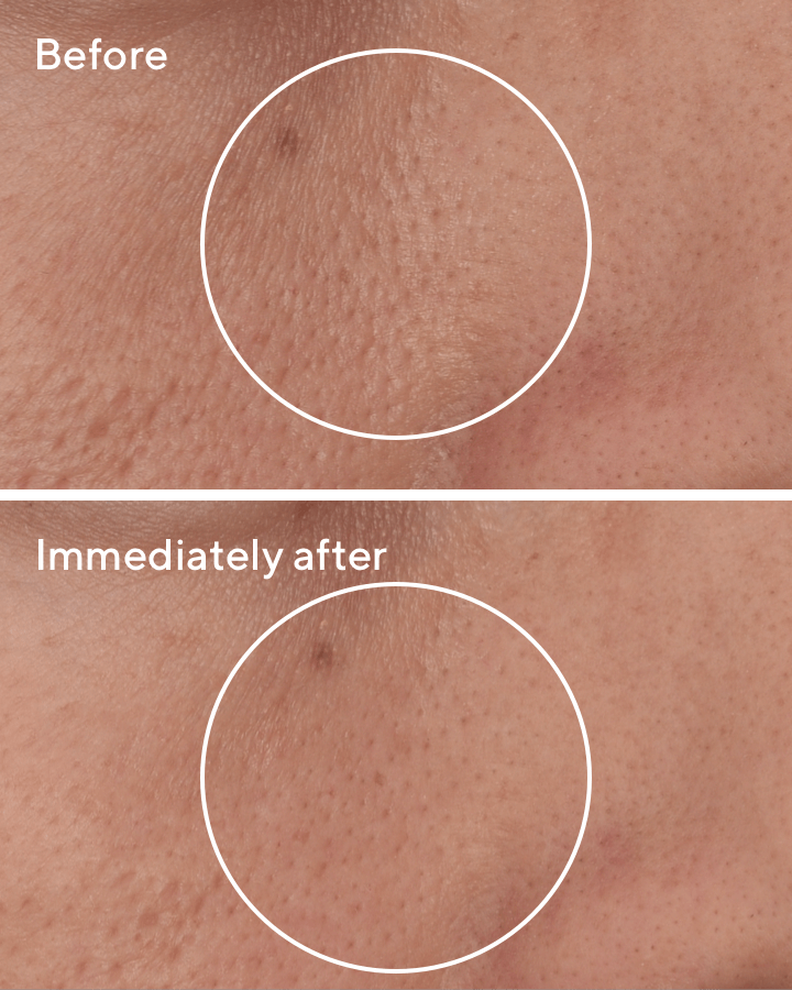 Murad - Corrector de Poros Localizado - Imagen 3
