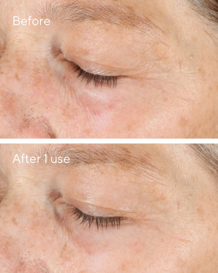Murad Vita-C Triple Exfoliating Facial Before & After